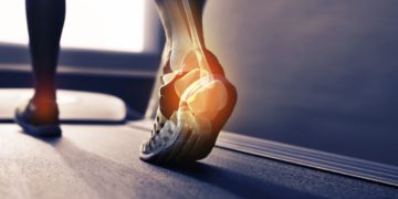 Physical Activity You Can Still Do While Your Ankle Heals