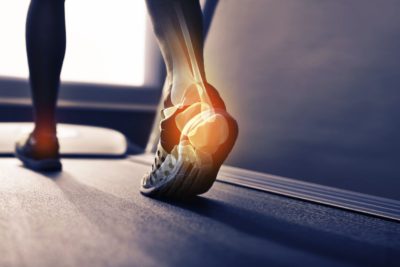 Physical Activity You Can Still Do While Your Ankle Heals
